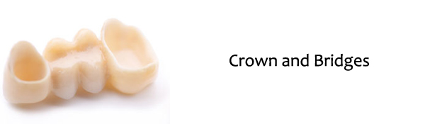 Raritan Dentist - Crown and Bridges