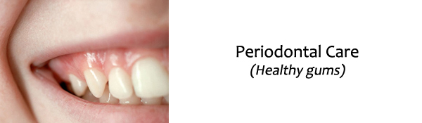 Raritan Dentist - Periodontal Care